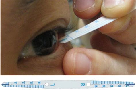 smtube tear test|Feasibility of Strip Meniscometry for Tear Volume Evaluation in .